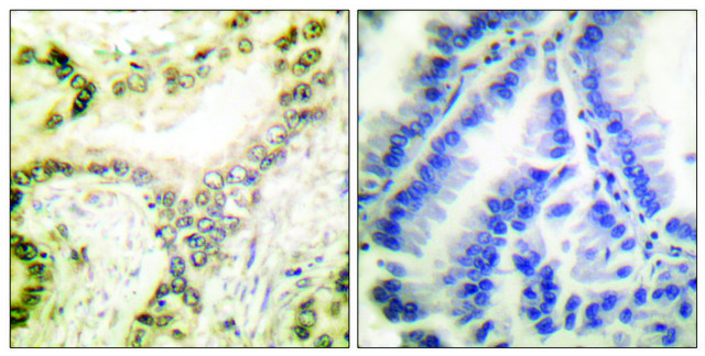 Anti-Histone H3 (Acetyl-Lys18) antibody produced in rabbit affinity isolated antibody