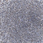 Anti-DRAM2 antibody produced in rabbit Prestige Antibodies® Powered by Atlas Antibodies, affinity isolated antibody, buffered aqueous glycerol solution