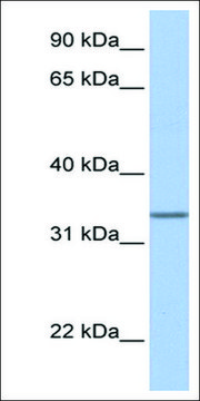 Anti-SPDEF (AB1) antibody produced in rabbit affinity isolated antibody