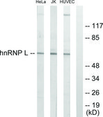 Anti-HNRNP L antibody produced in rabbit affinity isolated antibody