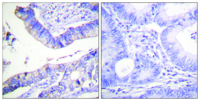 Anti-BCL-2 antibody produced in rabbit affinity isolated antibody