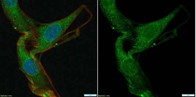 Anti-Partitioning-defective 3 Antibody Upstate&#174;, from rabbit