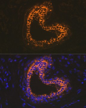 Anti-Cytokeratin 18 (KRT18) Antibody, clone 7B2N3, Rabbit Monoclonal