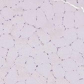 Anti-APLP1 antibody produced in rabbit Prestige Antibodies® Powered by Atlas Antibodies, affinity isolated antibody, buffered aqueous glycerol solution