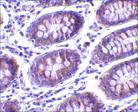 Anti-MICA antibody produced in rabbit affinity isolated antibody, buffered aqueous solution