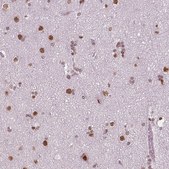 Monoclonal Anti-BRD4 antibody produced in mouse Prestige Antibodies® Powered by Atlas Antibodies, clone CL1118, purified immunoglobulin, buffered aqueous glycerol solution