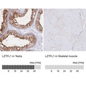 Anti-LZTFL1 antibody produced in rabbit Prestige Antibodies® Powered by Atlas Antibodies, affinity isolated antibody, buffered aqueous glycerol solution