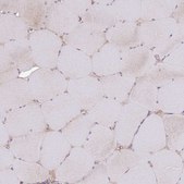 Anti-GMNN antibody produced in rabbit Prestige Antibodies® Powered by Atlas Antibodies, affinity isolated antibody, buffered aqueous glycerol solution