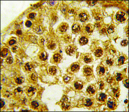 Anti-NASP (C-term) antibody produced in rabbit saturated ammonium sulfate (SAS) precipitated, buffered aqueous solution