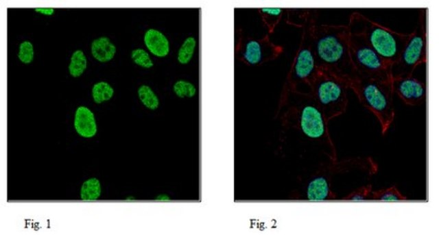 Anti-ADAR2 Antibody, clone 2D1.1 clone 2D1.1, 1&#160;mg/mL, from mouse