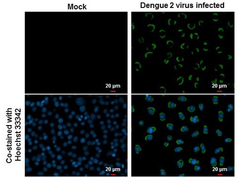 Anti-Envelope protein antibody produced in rabbit affinity isolated antibody, buffered aqueous solution