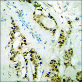 Anti-phospho-Retinoblastoma (pSer807) antibody produced in rabbit affinity isolated antibody
