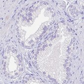 Monoclonal Anti-ARG1 antibody produced in mouse Prestige Antibodies® Powered by Atlas Antibodies, clone CL0186, purified immunoglobulin, buffered aqueous glycerol solution