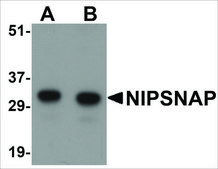 Anti-NIPSNAP (ab2) antibody produced in rabbit affinity isolated antibody, buffered aqueous solution