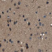 Anti-ARFGAP2 antibody produced in rabbit Prestige Antibodies® Powered by Atlas Antibodies, affinity isolated antibody, buffered aqueous glycerol solution