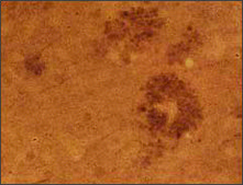 Anti-APOE antibody produced in rabbit affinity isolated antibody