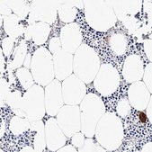 Anti-ITGA2B antibody produced in rabbit Prestige Antibodies® Powered by Atlas Antibodies, affinity isolated antibody, buffered aqueous glycerol solution