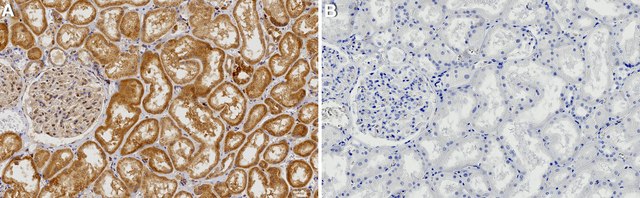 Anti-GPX1 Antibody, clone 1J19 ZooMAb&#174; Rabbit Monoclonal recombinant, expressed in HEK 293 cells