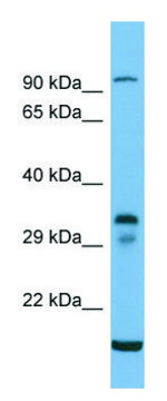 Anti-TM6SF2 (C-terminal) antibody produced in rabbit affinity isolated antibody