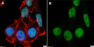 Anti-SUMO-2/3 Antibody, clone 1D9 ZooMAb® Rabbit Monoclonal recombinant, expressed in HEK 293 cells