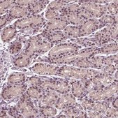 Anti-NUP210 antibody produced in rabbit Prestige Antibodies® Powered by Atlas Antibodies, affinity isolated antibody, buffered aqueous glycerol solution