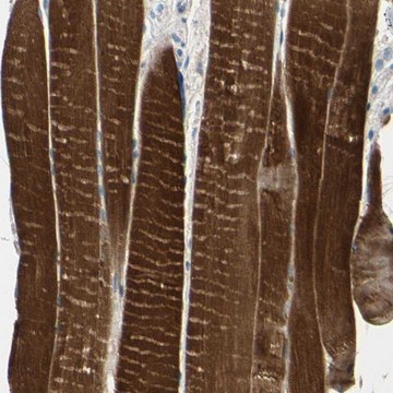 Anti-TPM3 antibody produced in rabbit Prestige Antibodies&#174; Powered by Atlas Antibodies, affinity isolated antibody, buffered aqueous glycerol solution