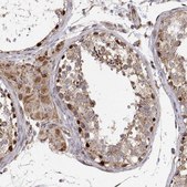 Anti-SPICE1 antibody produced in rabbit Prestige Antibodies&#174; Powered by Atlas Antibodies, affinity isolated antibody, buffered aqueous glycerol solution