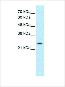 Anti-TSHR (AB2) antibody produced in rabbit affinity isolated antibody