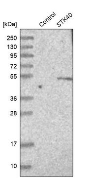 Anti-STK40 antibody produced in rabbit Prestige Antibodies&#174; Powered by Atlas Antibodies, affinity isolated antibody, buffered aqueous glycerol solution