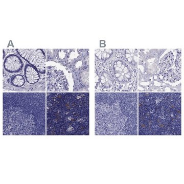 Anti-PSMB11 antibody produced in rabbit Prestige Antibodies&#174; Powered by Atlas Antibodies, affinity isolated antibody