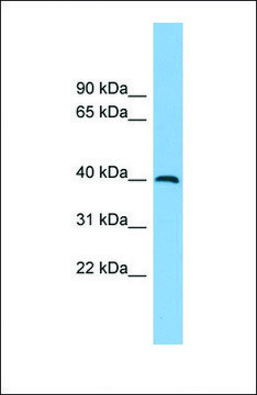 Anti-ADH5 antibody produced in rabbit affinity isolated antibody