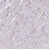 Anti-KRIT1 antibody produced in rabbit Prestige Antibodies® Powered by Atlas Antibodies, affinity isolated antibody, buffered aqueous glycerol solution