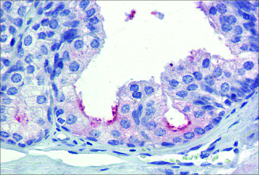 Anti-AMH antibody produced in rabbit affinity isolated antibody