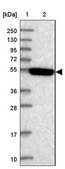 Anti-STYK1 antibody produced in rabbit Prestige Antibodies® Powered by Atlas Antibodies, affinity isolated antibody, buffered aqueous glycerol solution