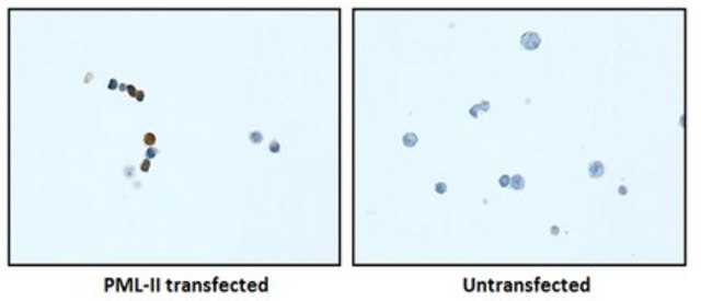 Anti-PML Isoform II Antibody, clone 1A8.1 clone 1A8.1, from mouse