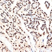 Anti-ANP32B antibody produced in rabbit