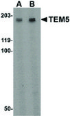 Anti-TEM5 antibody produced in rabbit affinity isolated antibody