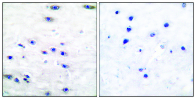 Anti-Tyrosine Hydroxylase, N-Terminal antibody produced in rabbit affinity isolated antibody