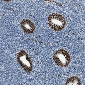 Anti-SLFN5 antibody produced in rabbit Prestige Antibodies® Powered by Atlas Antibodies, affinity isolated antibody, buffered aqueous glycerol solution