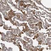 Anti-DDIT4 antibody produced in rabbit Prestige Antibodies® Powered by Atlas Antibodies, affinity isolated antibody, buffered aqueous glycerol solution