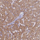 Anti-MGST1 antibody produced in rabbit Prestige Antibodies® Powered by Atlas Antibodies, affinity isolated antibody, buffered aqueous glycerol solution