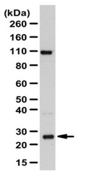 Anti-RAB8A Antibody from rabbit, purified by affinity chromatography