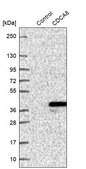 Anti-CDCA8 antibody produced in rabbit Prestige Antibodies® Powered by Atlas Antibodies, affinity isolated antibody, buffered aqueous glycerol solution