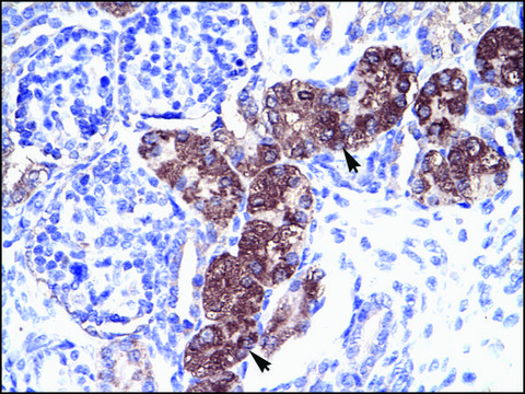 Anti-SOX18 affinity isolated antibody