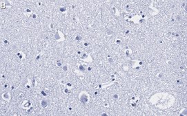 Anti-Prion Protein Antibody, clone 3D17 ZooMAb® Rabbit Monoclonal recombinant, expressed in HEK 293 cells