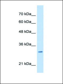 Anti-MLF2 (AB1) antibody produced in rabbit affinity isolated antibody