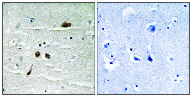 Anti-phospho-MDC1 (pSer513) antibody produced in rabbit affinity isolated antibody