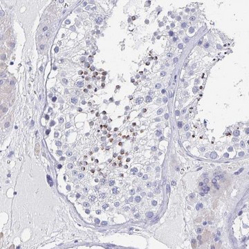 Anti-TNFRSF8 antibody produced in rabbit Prestige Antibodies&#174; Powered by Atlas Antibodies, affinity isolated antibody, buffered aqueous glycerol solution