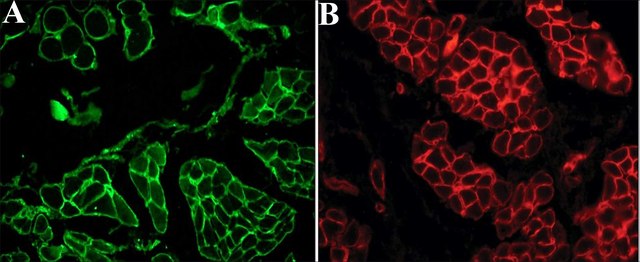 Anti-Laminin antibody, Mouse monoclonal clone LAM-89, purified from hybridoma cell culture