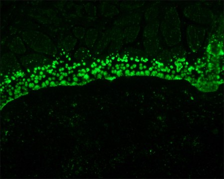 Monoclonal Anti-S100A6 antibody produced in mouse clone CACY-100, ascites fluid